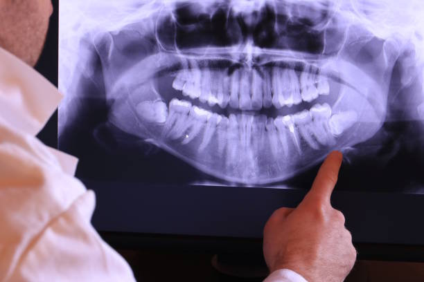 Best Broken Tooth Emergency  in Lebanon, VA