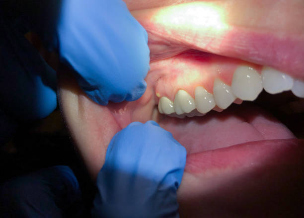 Best Dentist for Dental Trauma  in Lebanon, VA