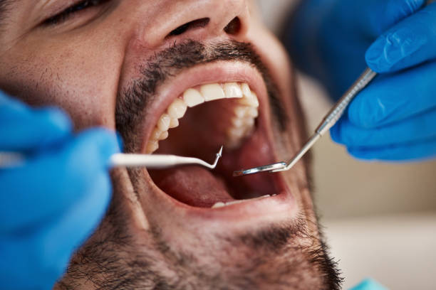 Best Broken Tooth Emergency  in Lebanon, VA