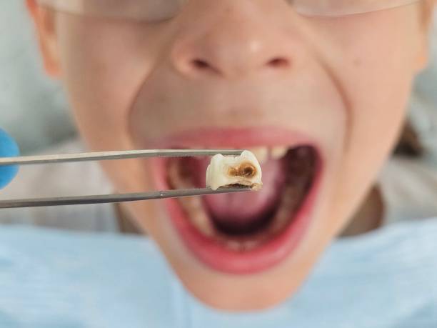 Best Emergency Pediatric Dentist  in Lebanon, VA